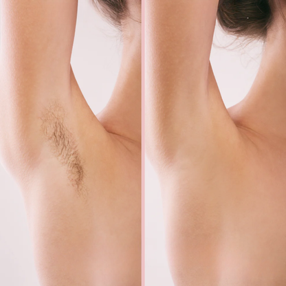 MYPEACHY® | Afeitadora Eléctrica 2 en 1: Depilación de Rostro y Cuerpo Sin Dolor ni Irritación